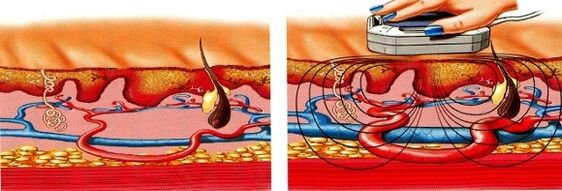 wann Är Been numm ginn